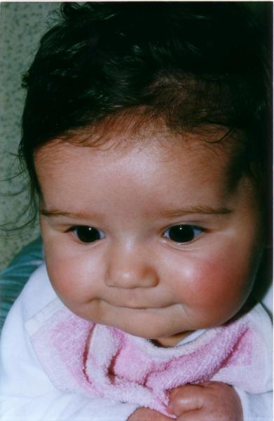 Bb joues